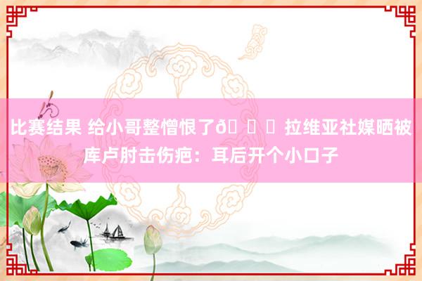 比赛结果 给小哥整憎恨了😅拉维亚社媒晒被库卢肘击伤疤：耳后开个小口子